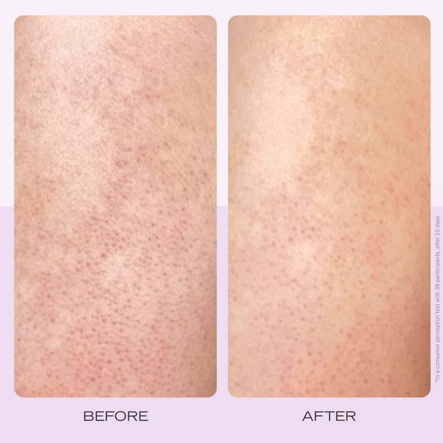 FIRST AID BEAUTY KP Body Scrub Strawberry - Gommage corps douceur immédiate AHA à la Fraise